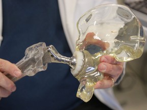 This 2014 photo shows a model of a hip replacement.