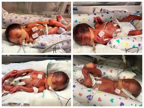 A birthday on Feb. 29 is rare enough, but on the leap year day in 2024, mother Savannah Ratt and father Gilbert Merasty welcomed a set of quadruplets into the world in Saskatoon: (clockwise, from top left) Aleah Merasty, Beautiful Merasty, Dominick Merasty and Cecilia Merast (Supplied photos)