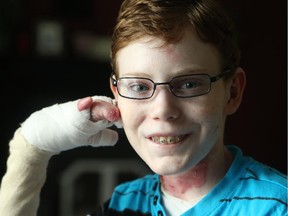 Jonathan Pitre.