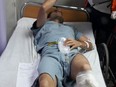 London emergency room doctor Tarek Loubani recovers after being shot in the leg during protests in Gaza Monday.