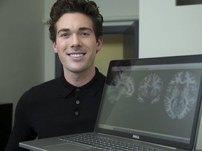 Dr. Andrew Nicholson with MRI images of brains at St. Joseph's Hospital in London. (Derek Ruttan/The London Free Press)