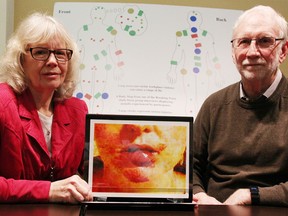 Researchers Margaret Keith and Jim Brophy have been investigating violence in Ontario's long-term care system. One of the battered personal support workers they spoke with is pictured. Behind them is a display workers used to identify where they'd been injured by the people for whom they're paid to care. Tyler Kula/Postmedia Network