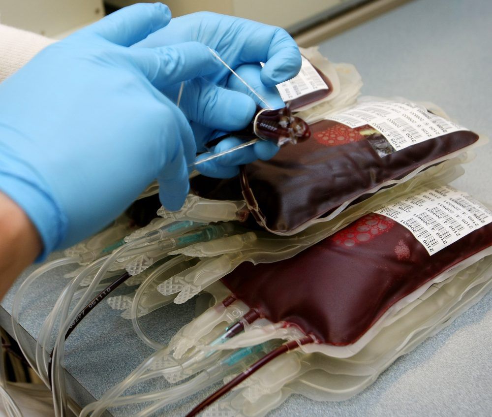 London-based study finds blood transfusions can be cut in cardiac ...