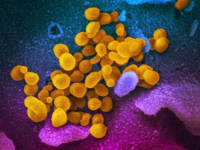 This electron microscope image made available by the U.S. National Institutes of Health shows the novel coronavirus SARS-CoV-2, yellow, emerging from the surface of cells, blue/pink, cultured in the lab. Also known as 2019-nCoV, the virus causes COVID-19.