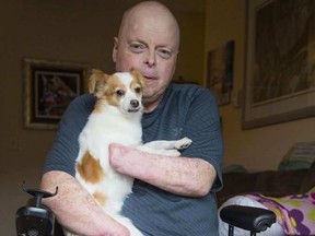 Rick Thompson says he's moving to London to prepare for possible double hand transplant surgery. (Francis Georgian/Postmedia Network)