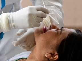 A health worker wearing personal protective equipment uses a nasal swab to take a sample to test for the COVID-19 coronavirus. (Getty Images)