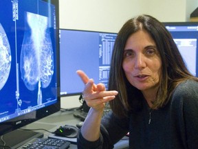 Using CESM, a specialized digital imaging technique,. to guide breast cancer biopsies has the potential to provide faster, more accurate procedures and cut costs, says London researcher and radiologist Anat Kornecki. (File)