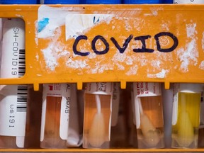 Specimens to be tested for COVID-19 are seen at LifeLabs after being logged upon receipt at the company's lab, in Surrey, B.C., on March 26, 2020.