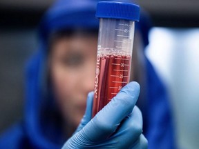 A scientist displays a test sample during diagnostic activity relating to SARS-CoV-2, the virus strain causing the coronavirus disease, at a research centre in Hungary. (AKOS STILLER /Bloomberg)