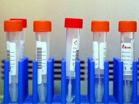 Patient swabs await testing for COVID-19