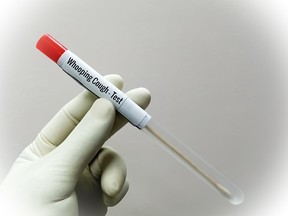 Scientist holding swab sample for whooping cough test, a disease by Bordetella pertussis bacteria. (Getty Images)