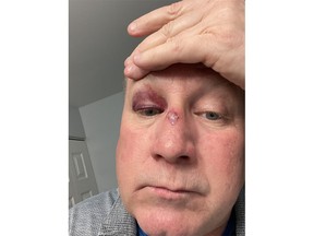 London outreach worker Rob Hoath, 58, alleges Jonathan Halfyard, 37, assaulted him in an unprovoked attack on March 21, one month before Halfyard was charged with second-degree murder in the death of his mother. (Submitted photo)