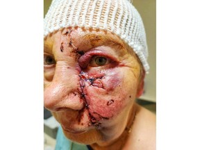 Chris Bonnett, age 75 of Nixon, Ontario is recovering in a Hamilton hospital after being attacked by dog November 1, 2023, outside her condominium complex in Norfolk County.