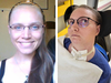 Elysse Elliott before (left) and after her brain injury, (right).