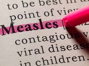 Potential measles exposure identified at two London-area ERs Potential measles exposure identified at two London-area ERs