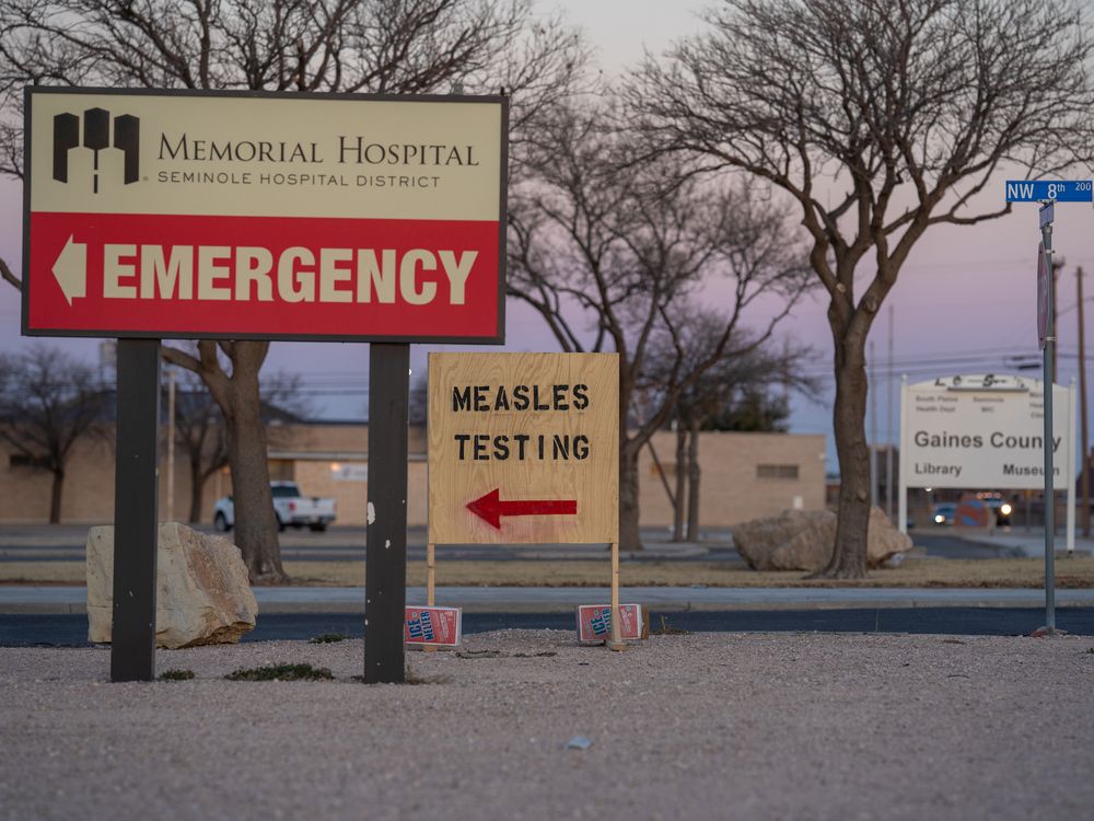 Signs point the way to measles testing in the parking lot of the Seminole Hospital District across from Wigwam Stadium on February 27, 2025 in Seminole, Texas. There have been 321 cases of measles reported in Gaines county. (Photo by Jan Sonnenmair/Getty Images)