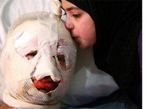 Fatima, 13, kisses her injured father, Ahmad al-Messmar, 40, who was wounded when a car bomb blew up in February in the Lebanese town of Hermel, an attack linked to the war in neighbouring Syria. Territory that was once within the multi-ethnic, multi-state, multi-religious Ottoman Empire is again engulfed in conflict, stretching from Syria to Libya, Jeffrey D. Sachs writes.