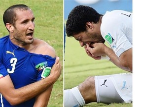 This combo of two photos shows Italy’s defender Giorgio Chiellini (L) showing an apparent bitemark and Uruguay forward Luis Suarez (R) holding his teeth after the incident during the Group D football match between Italy and Uruguay at the Dunas Arena in Natal during the 2014 FIFA World Cup on June 24, 2014. Suarez on June 30, 2014 apologized to Italian defender Giorgio Chiellini and to the entire “football family” for the bite for which he was penalized by the FIFA, in a message published on his official Twitter and Facebook accounts.