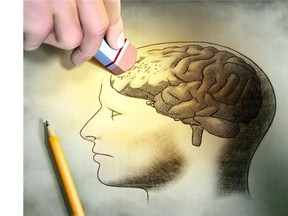 The Canadian Consortium for Neurodegeneration and Aging brings together the best of the crop already in the dementia field, about 350 scientists and 20 teams of experts from across the country. (Digital illustration by Andrea Danti/Fotolia.com)