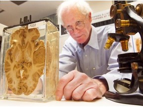 Dr. Richard Fraser with a sample at the Montreal General Hospital from the 1930s that came from a 57-year-old man who had had headaches for several years. A slice of the brain shows a four-centimetre brown tumour (middle/right) compressing the adjacent cerebral tissue. The Montreal General Hospital is holding a two-day exhibit featuring autopsy samples and a chance for the public to try their hand at suturing, tying knots and making surgical cuts using cameras and monitors.