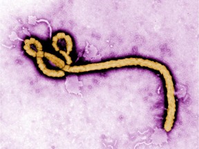 Ebola