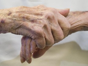 An elderly man's hands are shown at Westmount One Senior's residence in Montreal, Thursday, April 19, 2012.