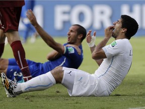 Uruguay's Luis Suarez holds his teeth after running into Italy's Giorgio Chiellini's shoulder during a group D World Cup soccer match in Natal, Brazil on June 24, 2014.