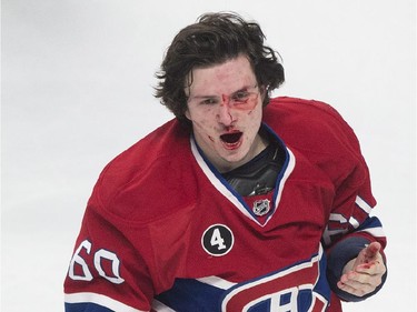 A bloody Montreal Canadiens' Christian Thomas walks off the ice following a fight with Columbus Blue Jackets' Matt Calvert during third period NHL hockey action in Montreal, Saturday, February 21, 2015.