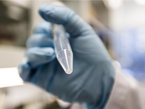 A research technician shows a plastic test tube with DNA from a patient.