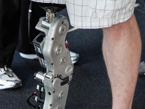 Man stands on his bionic leg.