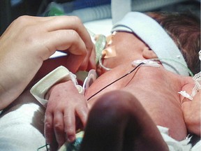 A nurse gives a premature baby its soother under a phototherapy lamp.