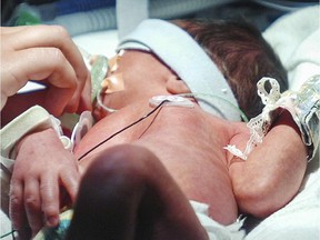 A nurse gives a premature baby its soother under a phototherapy lamp, in the Neonatal Intensive Care Unit at the  Royal Victoria Hospital in Montreal Monday August 13 2007.  (Tyrel Featherstone/THEGAZETTE)