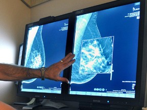 A radiologist compares an image from earlier, 2-D technology mammogram to the new 3-D Digital Breast mammography. The technology can detect much smaller cancers earlier.