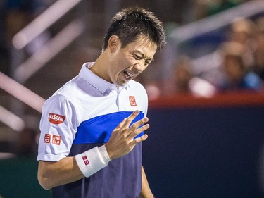 Kei Nishikori of Japan reacts after losing a point against Rafael Nadal of Spain during their quarter-finals tennis match for the Roger's Cup Tennis Tournament at Uniprix Stadium in Montreal on Friday, August 14, 2015.