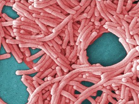 This undated image made available by the Centers for Disease Control and Prevention shows a large grouping of Legionella pneumophila bacteria (Legionnaires' disease).