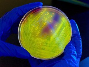 C. difficile bacteria in a petri dish.