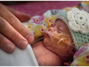 In this July 30, 2014 photo, Alexandra Mae Van Kirk recovers from surgery at Helen DeVos Children's Hospital in Grand Rapids, Mich. The 2-pound Michigan newborn dubbed "Mighty Girl" by her parents is one of the smallest babies in the world to undergo a heart procedure to open up a blocked artery caused by a congenital defect.