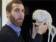 In this file photo, Dave Ellemberg , a neuropsychologist and professor at Université de Montréal, shows how an electrodes sensor net can record brain activity in his lab on Nov. 13, 2013.
