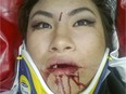 Susan Wu Martinez took a selfie after an accident on an STM bus  on Nov. 28.
