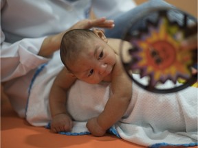 Three-month-old Daniel, who was born with microcephaly, undergoes physical therapy at the Altino Ventura foundation in Recife, Brazil, Thursday, Jan. 28, 2016. Brazilian officials still say they believe there's a sharp increase in cases of microcephaly and strongly suspect the Zika virus, which first appeared in the country last year, is to blame. The concern is strong enough that the U.S. Centers for Disease Control and Prevention this month warned pregnant women to reconsider visits to areas where Zika is present.