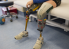 Mykola Nyzhnykovskyi, 11, waits for the start of a session where he walked on his prosthetic legs with a physiotherapist at Shriners Hospitals for Children in Montreal Tuesday, March 15, 2016. Mykola lost his legs and an arm in East Ukraine and sustained other serious injuries from an exploding grenade that killed his younger brother.