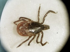 This file photo shows a deer tick under a microscope in the entomology lab at the University of Rhode Island in South Kingstown, R.I.