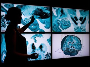 A researcher at McGill illustrates the three-dimensional MRI scans brain surgeons often have to rely on. The Montreal Neurological Institute’s partnership with IT giant EMC will help enhance their ability to map the brain in pinpoint 3D.