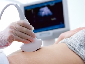 Pregnant woman getting ultrasound from doctor