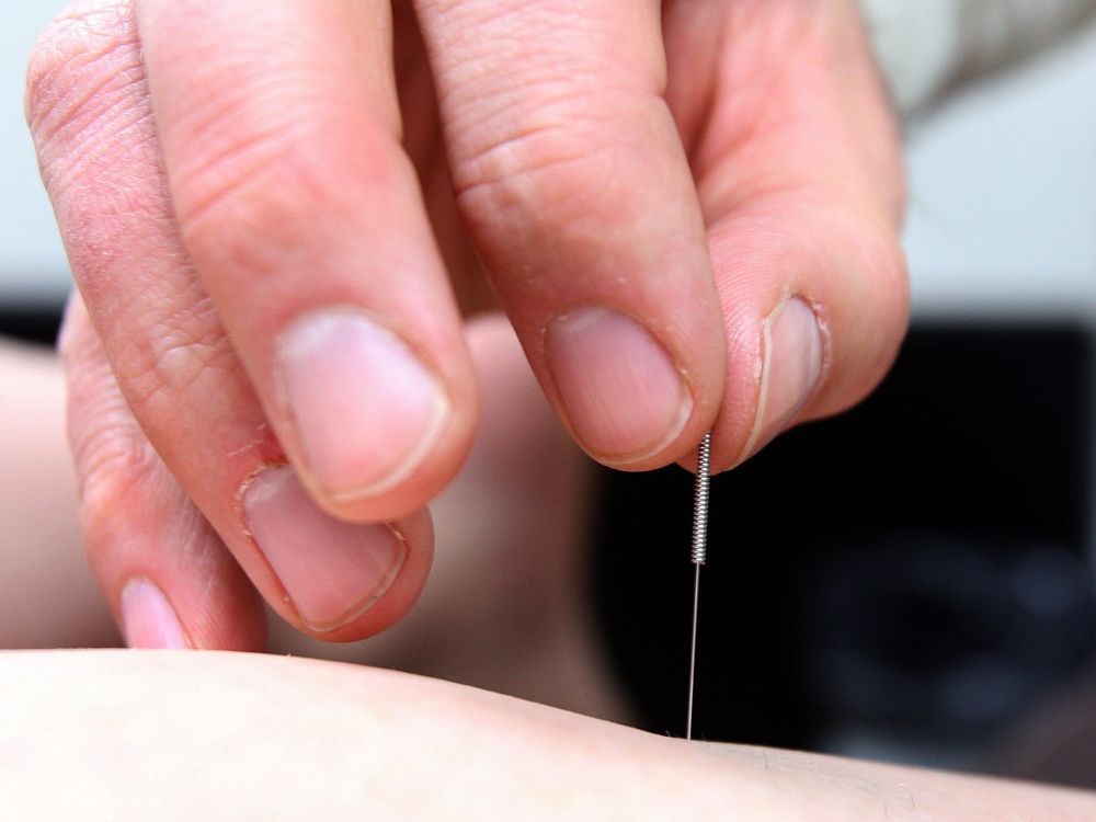the trouble with acupuncture, point by point
