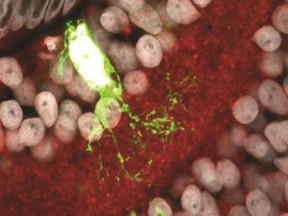 Tadpole eye stained to reveal cannabinoid receptors (red). A single fluorescently labeled cell (green) is shown at greater magnification.