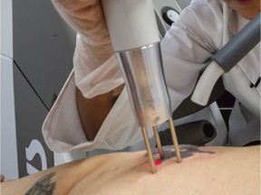 A new report is demanding stricter guidelines for disinfecting in tattoo parlours and that all tattoo laser or chemical removal procedures only be performed by qualified medical professionals.