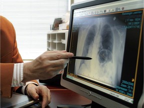 A physician examines a patient's chest x-ray on the computer in his office.