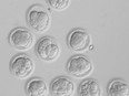 This undated image made available by the Oregon Health and Science University in May 2013 shows developing cloned human embryos. Scientists have finally recovered stem cells from cloned human embryos, a longstanding goal that could lead to new treatments for such illnesses as Parkinson's disease and diabetes.