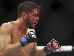 Montreal's Patrick Côté pauses during a welterweight mixed martial arts bout at UFC 210 against Thiago Alves, Saturday, April 8, 2017, in Buffalo, N.Y.